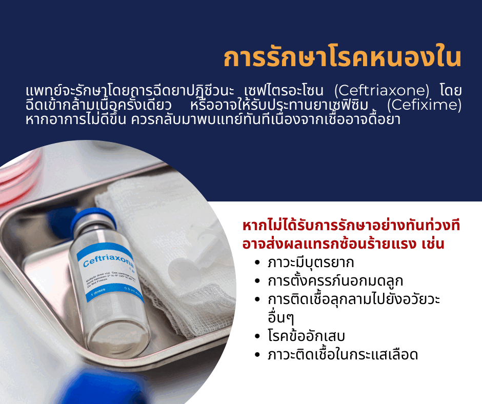การรักษาโรคหนองใน