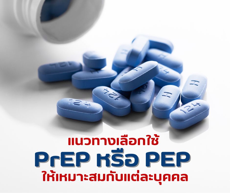 แนวทางเลือกใช้ PrEP หรือ PEP ให้เหมาะสมกับแต่ละบุคคล
